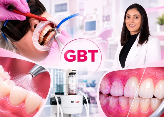 GBT (Guided Biofilm Therapy)